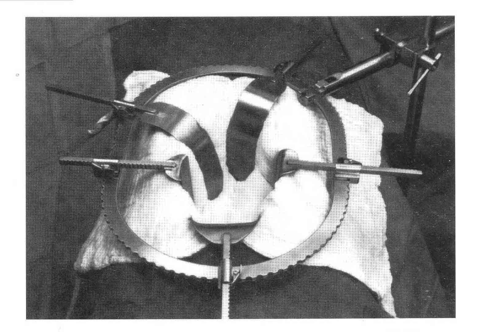 EKARTÖR BAĞLANTI APARATI  